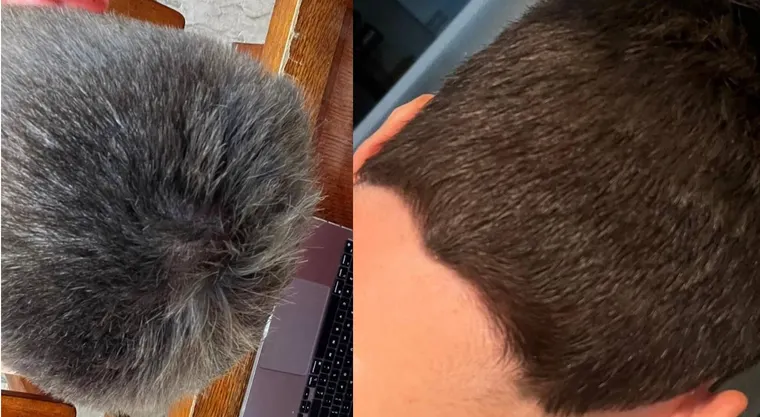 Before-and-after image supplied to illustrate Antal's white-hair claim