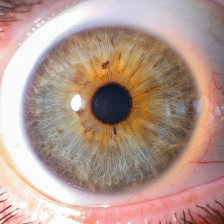 Iris with an orange/yellow ring around the pupil