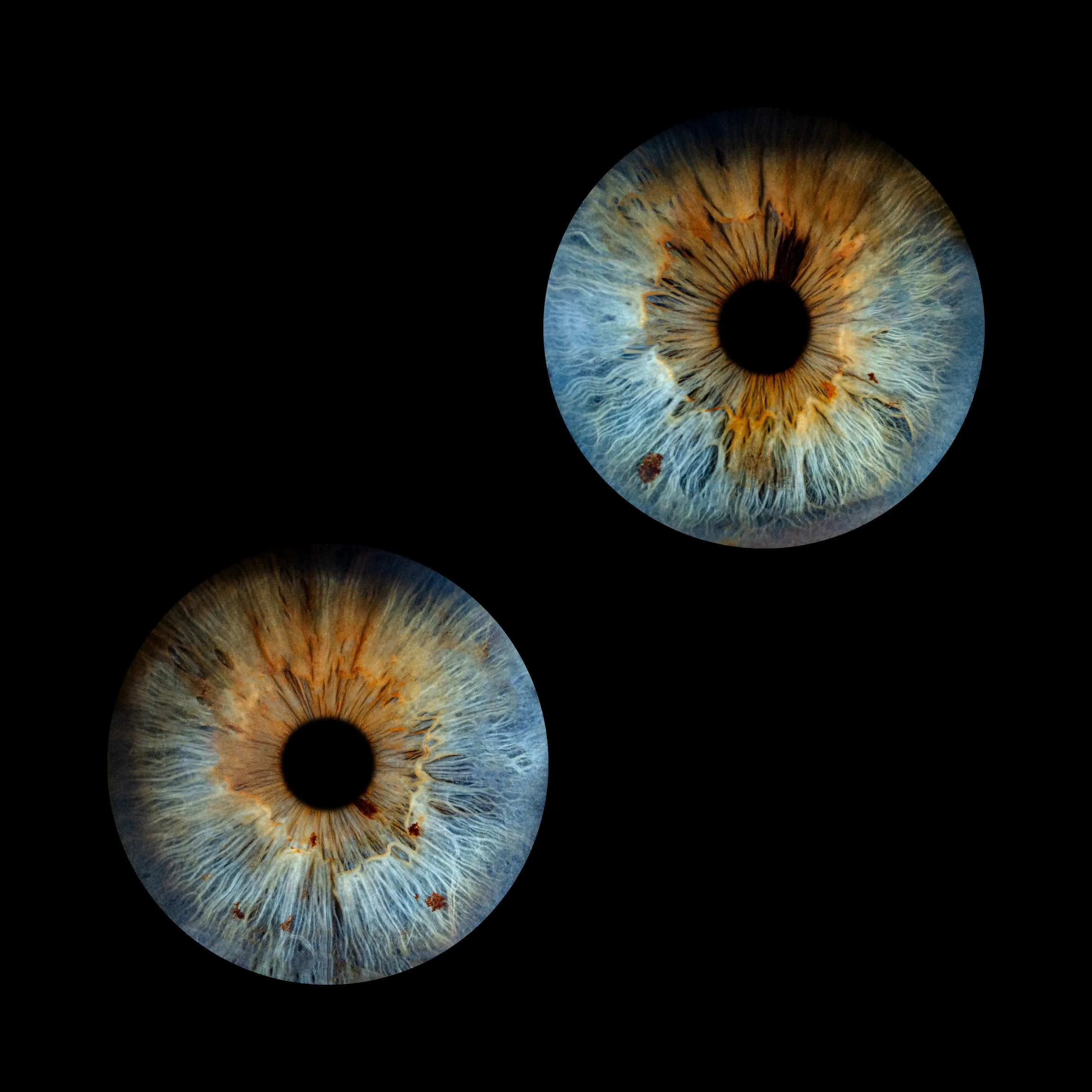 Two iris photos used as the Aajonus connective tissue and skin example