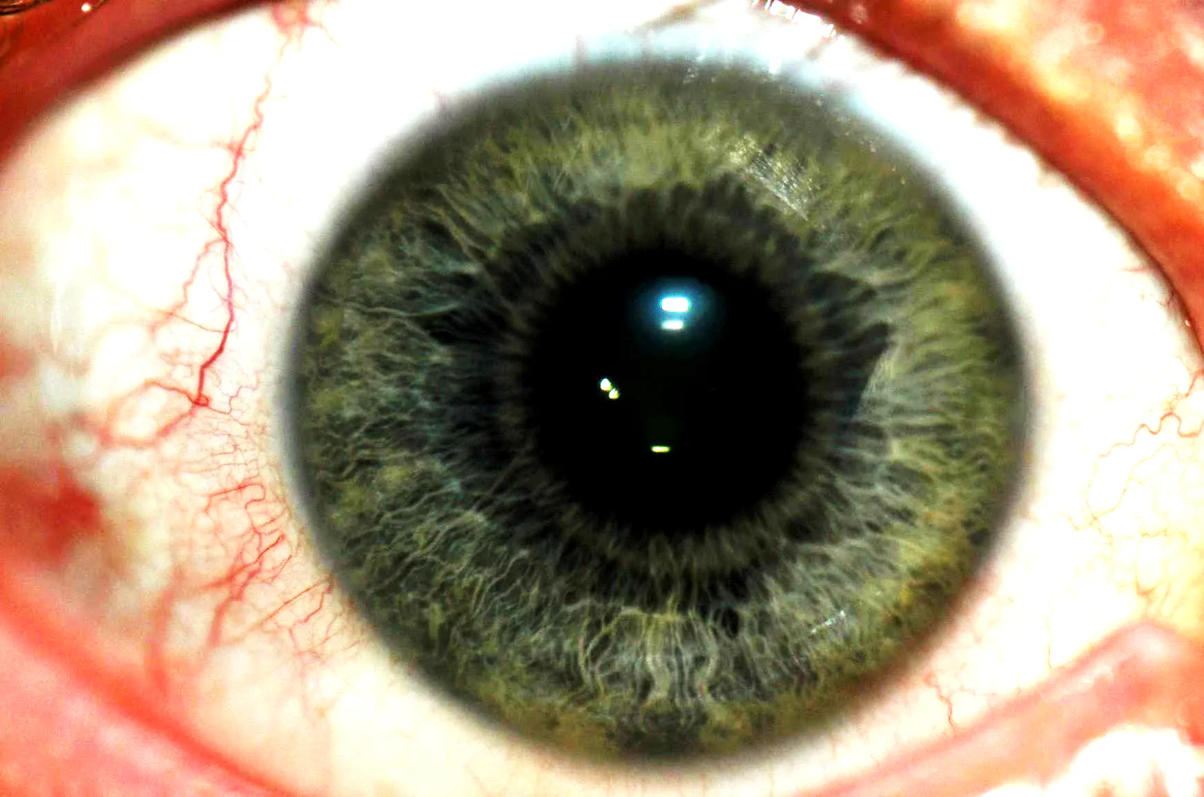 Greenish iris photo showing wavy fibers