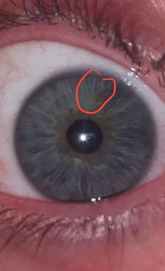 Close-up iris photograph from an anonymous person with a circled left communication-center area